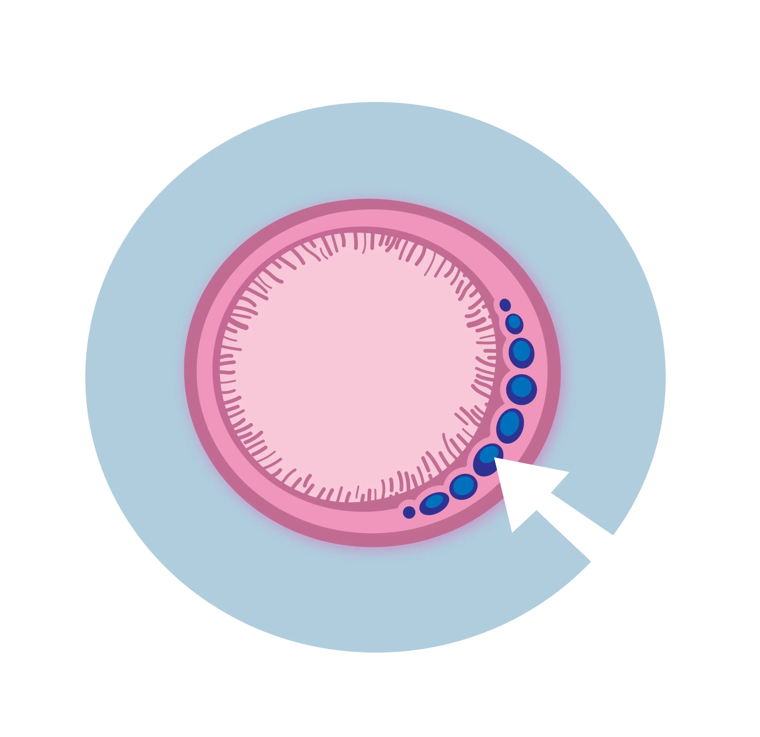 Gut illustration related to SIBO and intestinal health