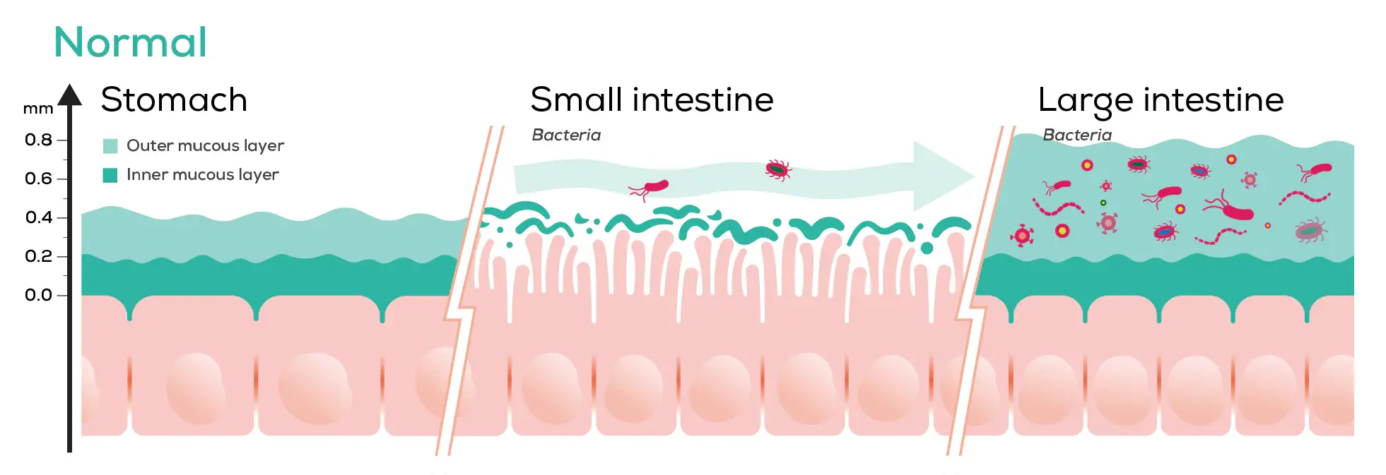 Illustration explaining SIBO and intestinal barrier function